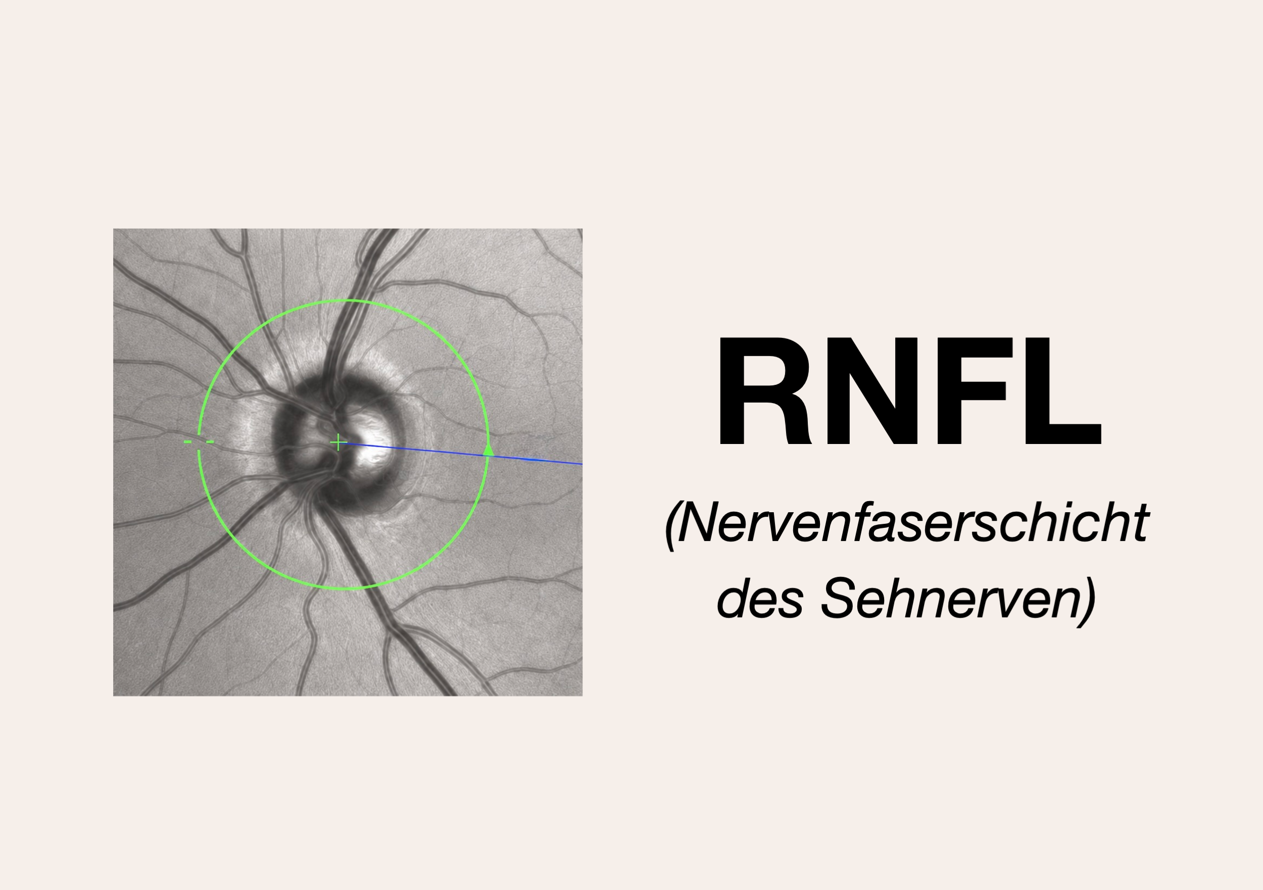 RNFL – Vorderseite